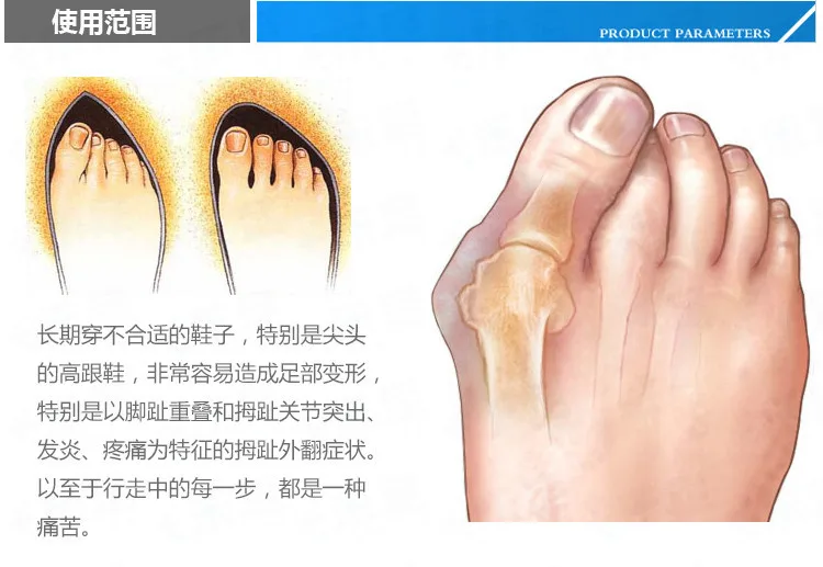 1 пара LittleToe мизинец большого пальца для ежедневного использования Hallux Valgus силиконовый разделитель для большого пальца накладка против