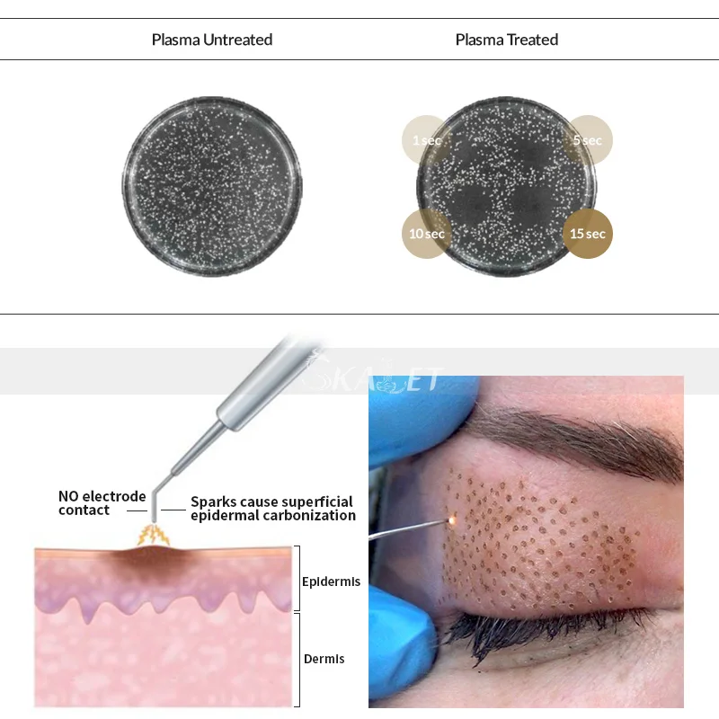 Медицинский CE салон использование плазменной кожи омоложение глаз мешок удаления струи лифтинг плазменная ручка 2 ручки плазменный гель косметическое устройство