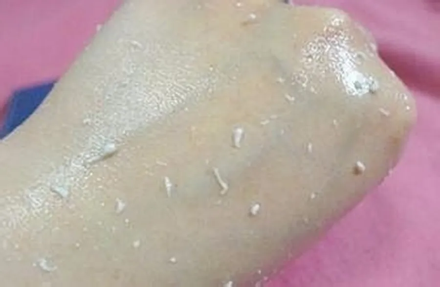 Extrato de Caviar Cuidados com a Pele à Base de Plantas Salão de Beleza Esfoliante Deadskin Leve Estimulação Corpo Facial 1000g Gel Não 7 Leve não estimulação Corpo Esfoliante Facial Salão de Beleza 1000g
