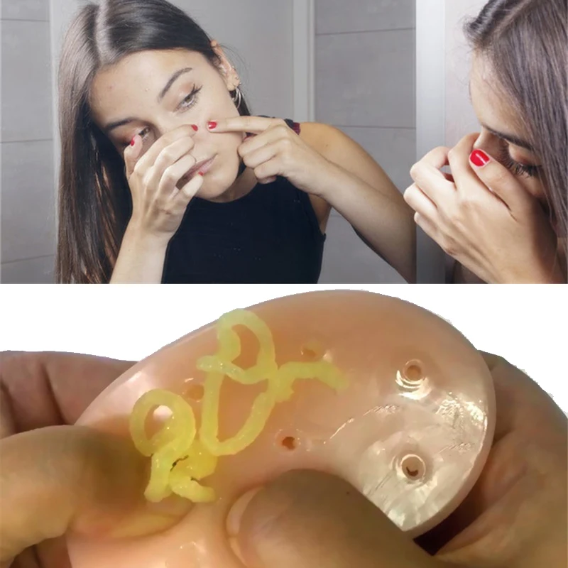 

1Pc Squeeze Acne Toy Love Heart Shape Peach Pimple Popping Stress Reliever Popper Remover Stop Picking Face Pimples Anti-stress