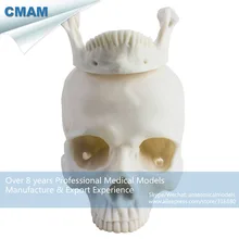 CMAM-PRC64 Embryo Resin Model Medical Realistic White Life Size Human Skull Model Anatomy