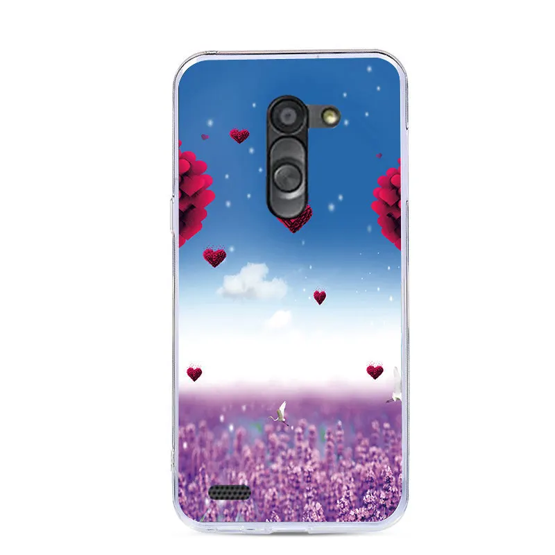 J&R Transparent Clear Phone Case For LG L Bello D331 D335 L Prime D337 Silicone Back Cover Cartoon Animals Flower Plants Cases