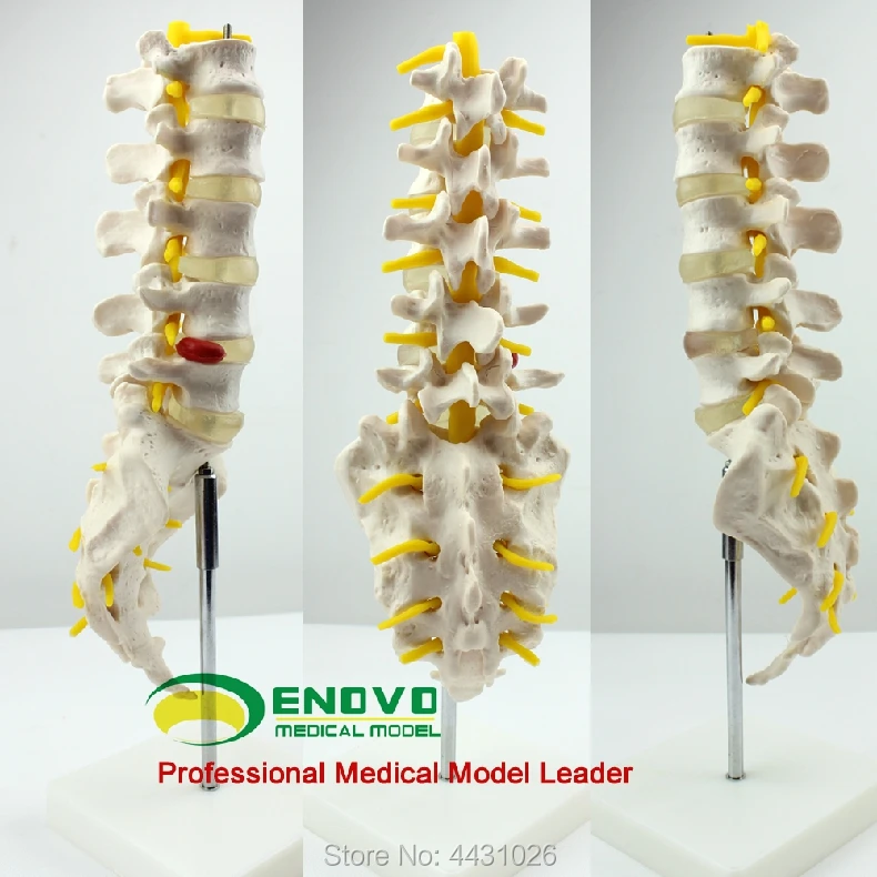 ENOVO скелет модель межпозвоночных дисков ортопедические модели