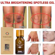 10 мл/30 мл ультра осветляющее масло без пятен отбеливание темное пятно выцветание пигментные пятна удаление ухода за кожей гипер пигментация эссенция масло