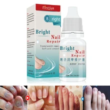 Высокое качество 10 мл грибки для ногтей Treatmen Foot защитный крем грибки для ногтей травы ногти ремонт крем уход за ногтями Инструменты