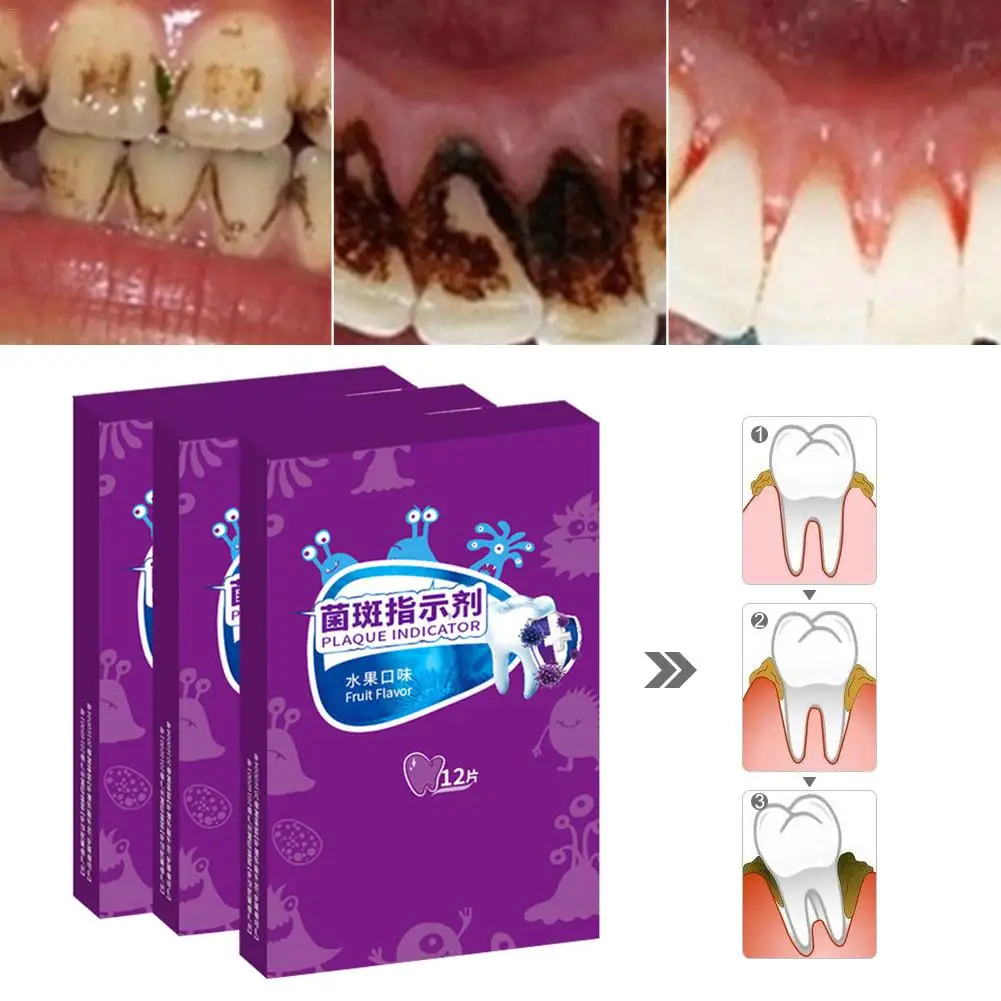 

12PCS Dental Plaque Disclosing Tablet 12 Tabs Show Plaque Stain On Teeth For Oral Care Teeth Cleaning Teeth Whitening Correction