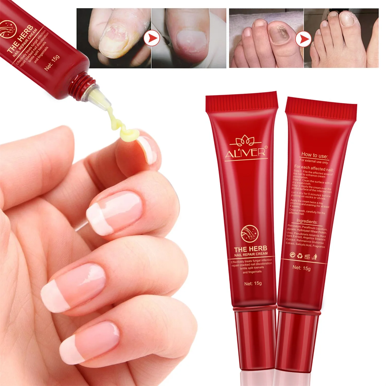 

Good Result Toe Nail Fungus Treatment Cream Onychomycosis Paronychia Anti Fungal Nail Infection Chinese Herbal Material Ointment