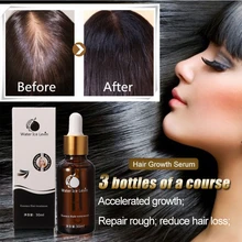30 мл шампунь быстрый рост волос сыворотка для лечения выпадения волос волокна растущие-быстрее