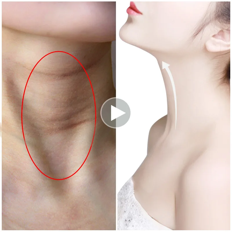 MEIKING 100% colágeno antiedad máscara de cuello antiarrugas blanqueamiento nutritivo mejor cuello crema apretada cuello elevador cuidado de la piel