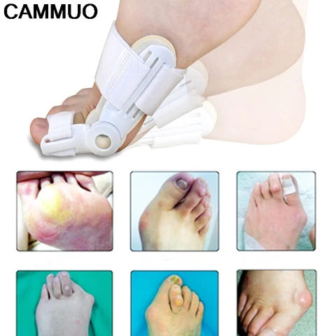 Toe Separator 24 Hours Bunion Orthotics Pedicure Hallux Valgus Corrector Pro Orthopedic Adjuster Big Toe Feet Care