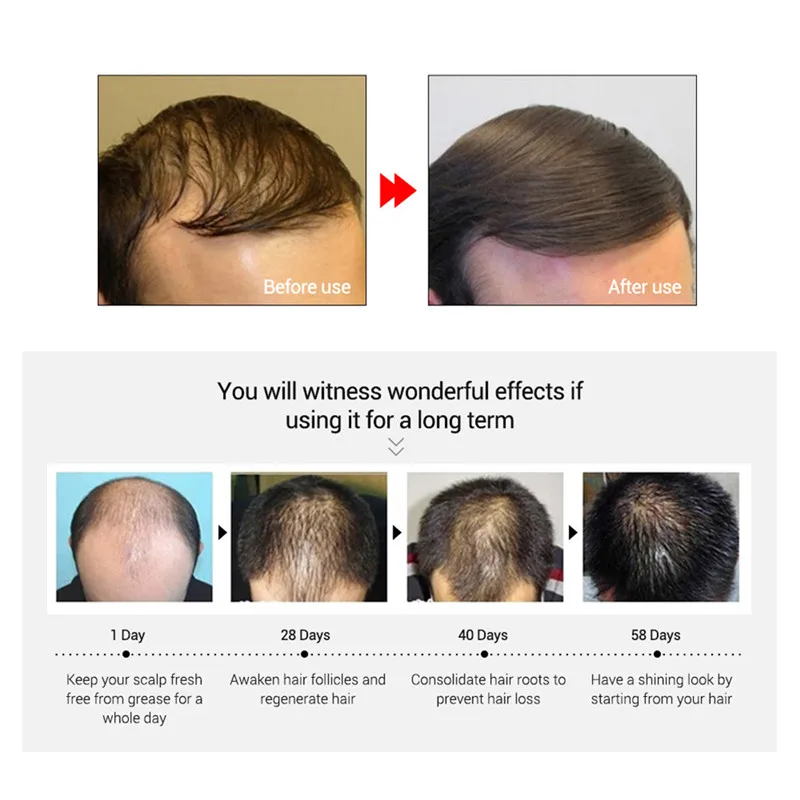 

Okeny's 20ml Hair Growth Essence Fast Powerful Hair Care Essential Oil Liquid Treatment Preventing Hair Loss Baldness protection
