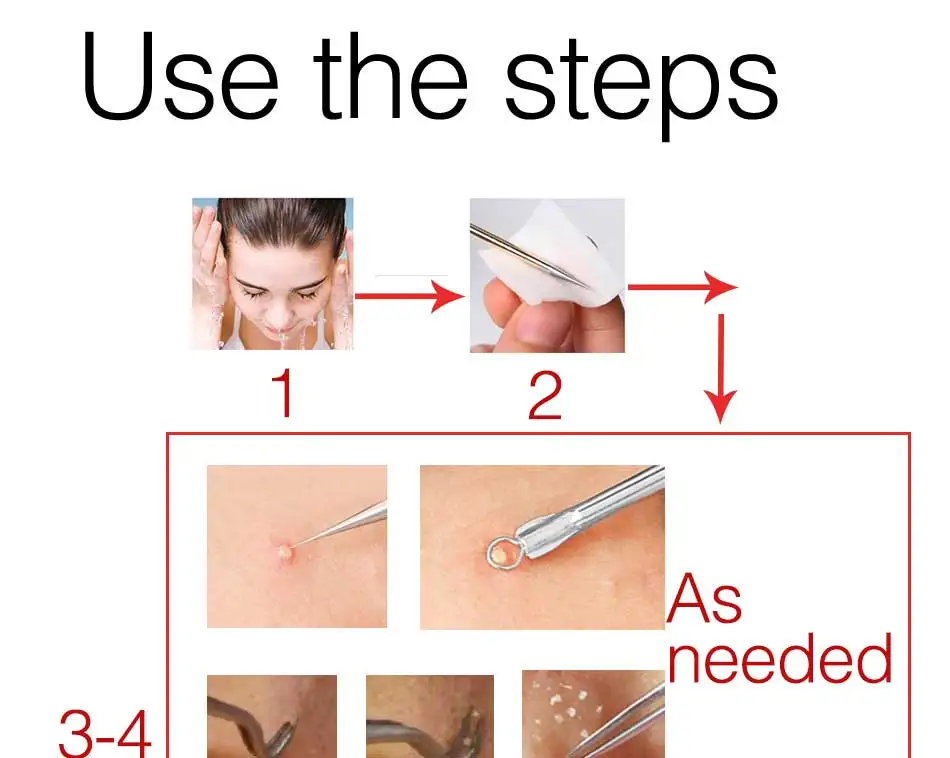 Blackhead-Remover-Tools-Pimple-Acne-Comedone-Zit-Extractor-Removal-Kit-Face-Cleaning-Kit-Treatment-for-Blemish-with-Mirror-Case_13
