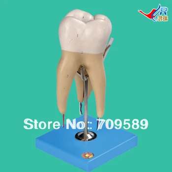 

Molar Model with 3 Root , Molar Teeth Model