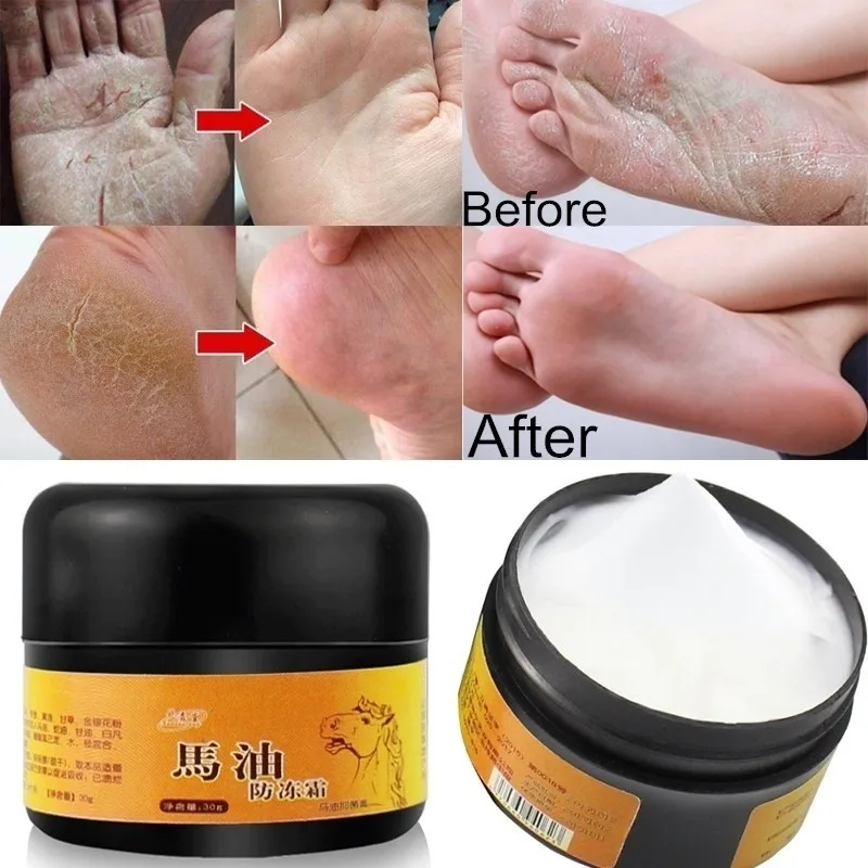 

Horse Oil Foot Hand Antifreeze Cream Treatment Dry Skin Heel Chapped Peeling Repair Anti Chapping Wrinkle Treatment Ointment