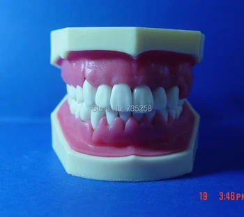 

Advanced Periodontal Disease Model,Oral And Periodontal Disease Teaching Model