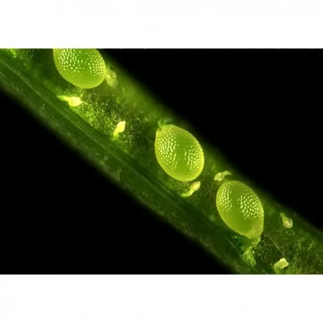 Fluorescence-microscope