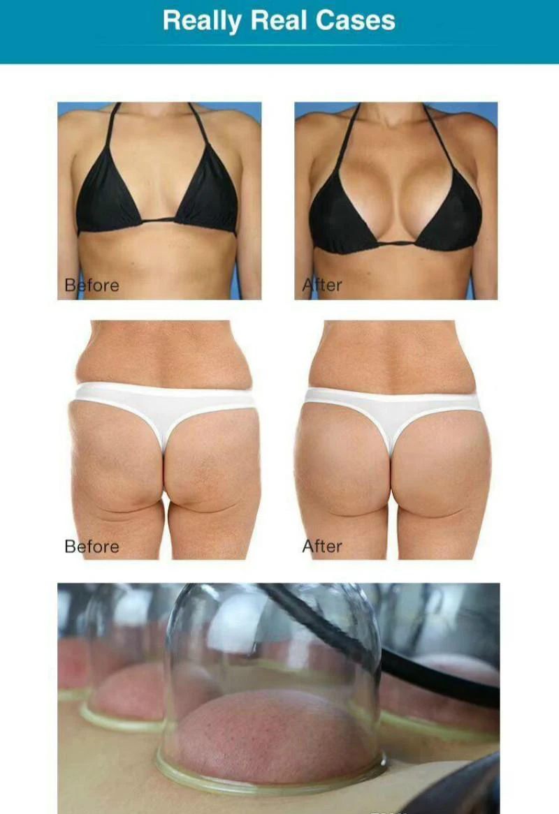 Breast Enlargement Body shaping Vacuum Massage Therapy With Breast Enlargement Cellulite Removal Machine For Salon Use 5
