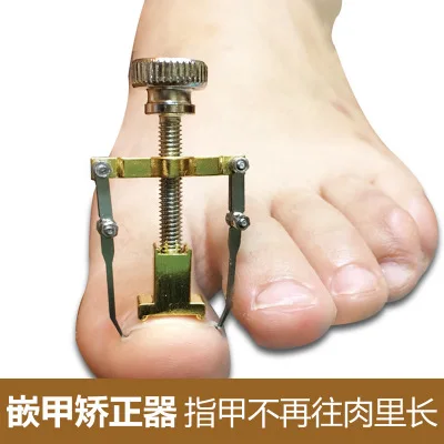 

Inflammation Toes Nail Pain Correction Device Toe Nail Correction Tool Fixer Recover Tools Ingrown Toenails Pedicure Tool
