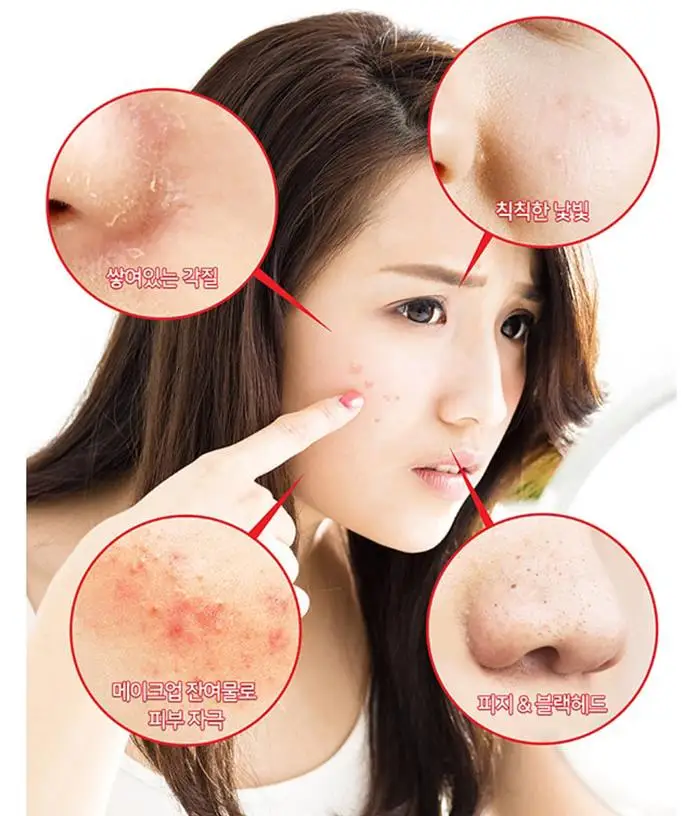 Ceny Niektóre przez MI AHA BHA PHA 30 dni cud z tonerem 150 ml + cud Serum 50 ml + cudowny krem 50 ml zaskórniki usunąć leczenie trądziku