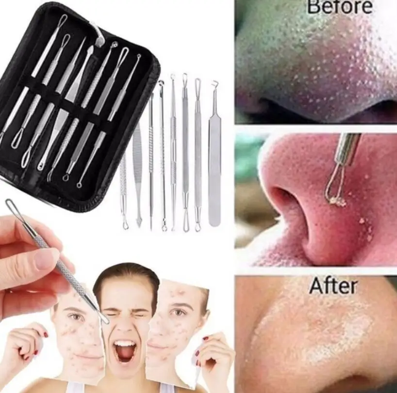 3 4 5 7 8 Pc Facial Comedone Acne Needle Remover Acne Treatment Set