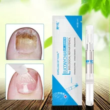 3 мл противогрибковые ручки для ногтей Onychomycosis Paronychia инфекция травяной носок пальцы ногти Здоровье Красота аксессуары