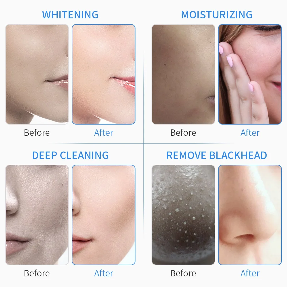 6 In 1 Water Dermabrasion Machine Deep Cleansing Machine Water Jet Hydro Diamond Facial Clean Dead 4
