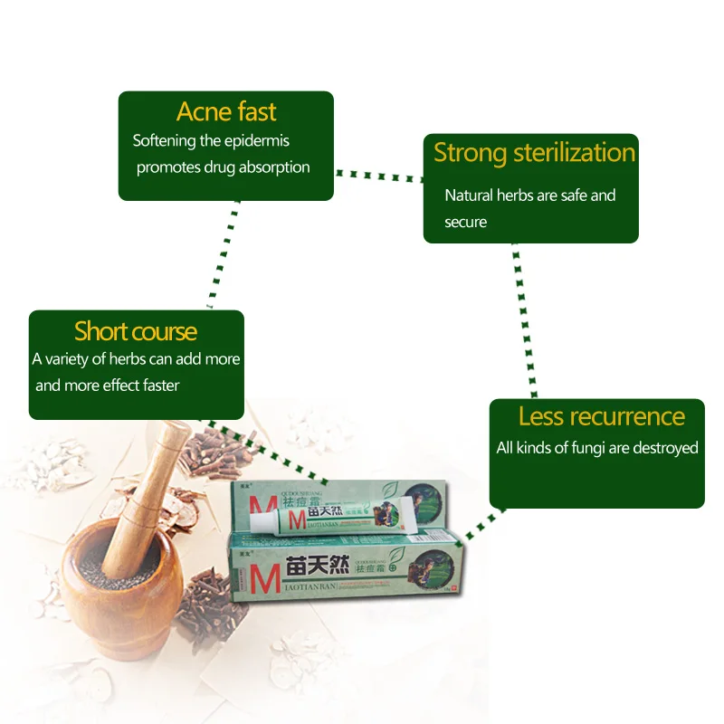 Китайская медицина, специальный крем для лечения акне, для лица, Удаление прыщей, профессиональный уход за акне, крем для лица без пятен, 18 г