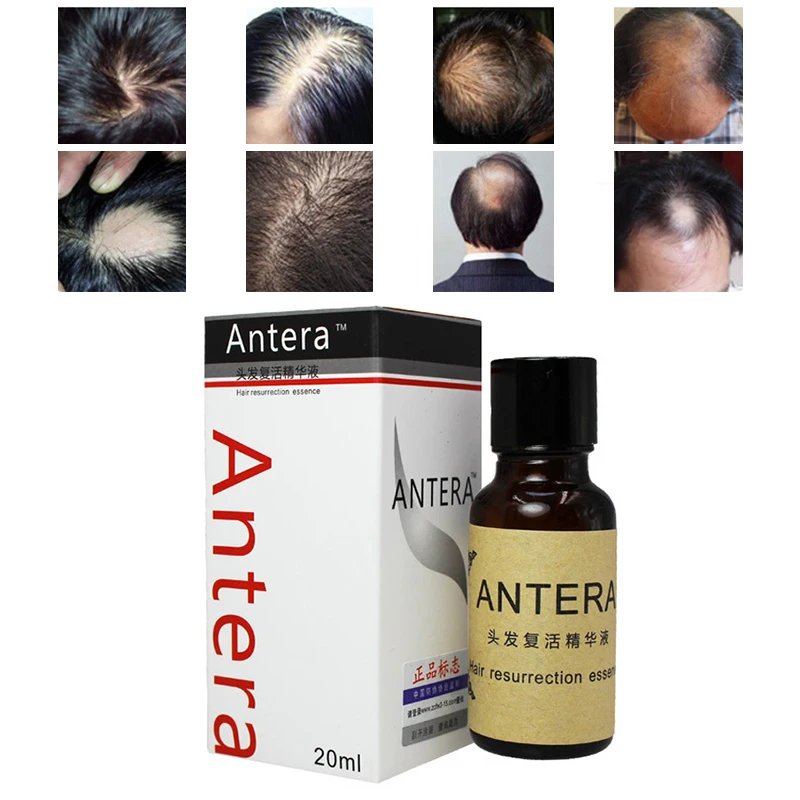 20 мл эссенция для роста волос, органическое кокосовое аргановое масло для лечения волос, продукты для быстрого роста волос, сыворотка