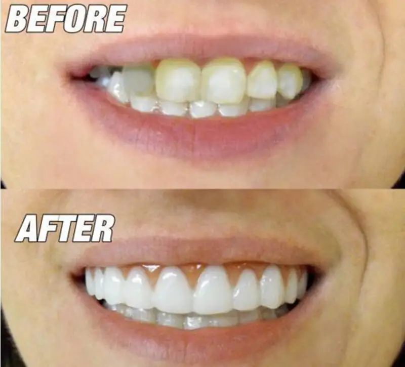 smile7