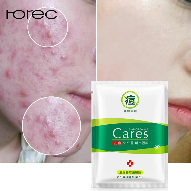 

ROREC Hyaluronic Acid Face Mask Treatment Acne Blackhead Repair Acne Remover Black Dot Clay Mask Oil-control Whitening Skin Care