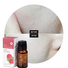 Красивое масло для лица V тонкое массажное розовое эфирное масло жир сжигание увлажнение и отбеливание кожи крем средство для ухода за лицом 10 мл