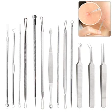 Средство для удаления угрей и угрей из нержавеющей стали, инструмент для удаления черных точек, инструмент для удаления прыщей, 1 комплект