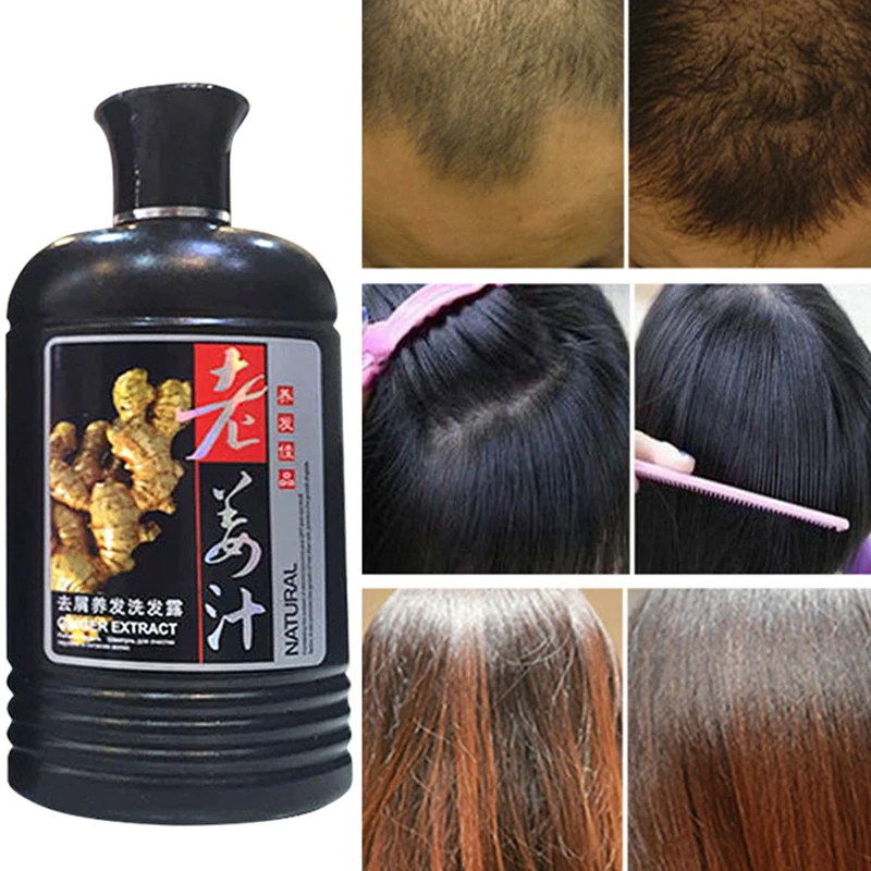 

400 ml Ginger juice anti-hair Products loss shampoo against dandruff oil control issuance dense hair growth solution repair