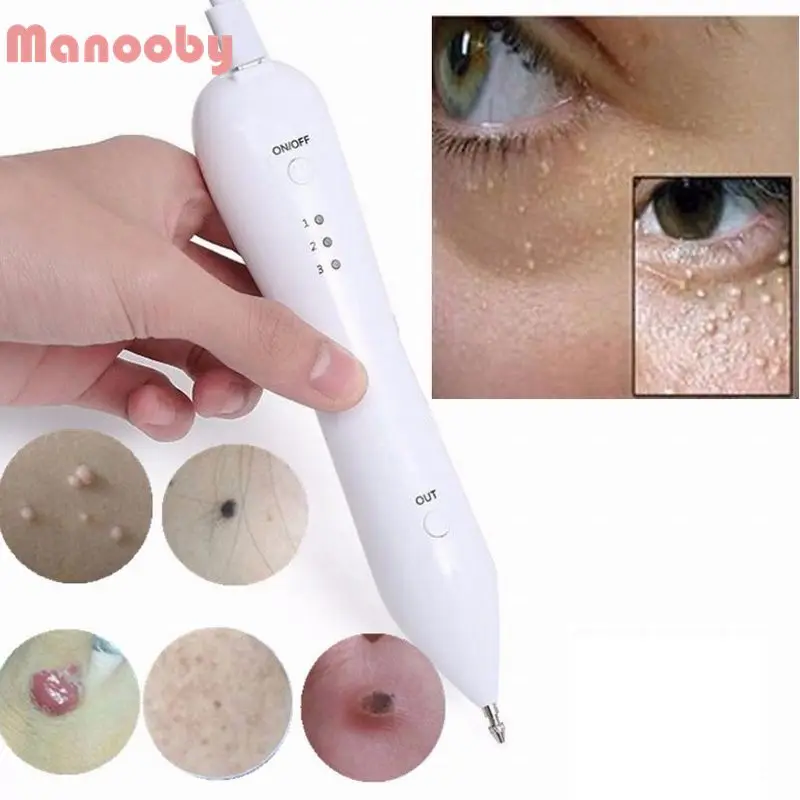 

Beauty Instrument Laser Freckle Removal Machine Skin Mole Removal Dark Spot Remover for Face Wart Tattoo Remaval Pen