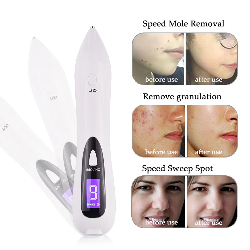 spesifikasi Raiuleko Portable LCD Laser Plasma Pena Wajah Bintik Kutil Remover Alat Tato Penghilang Tahi Lalat Gelap Tempat Remover Kulit Wajah perawatan