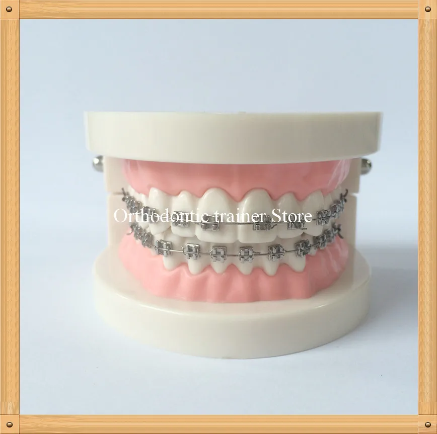 Orthodontic teeth model-2
