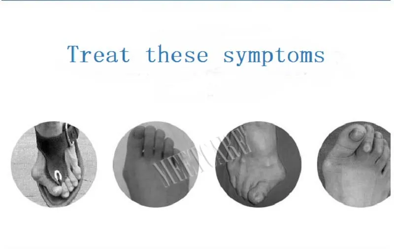 Выпрямитель для ног ортопедические подтяжки вальгусная коррекция носка фиксированный корректор большого пальца разделители костей ортопедическое средство по уходу за ногами