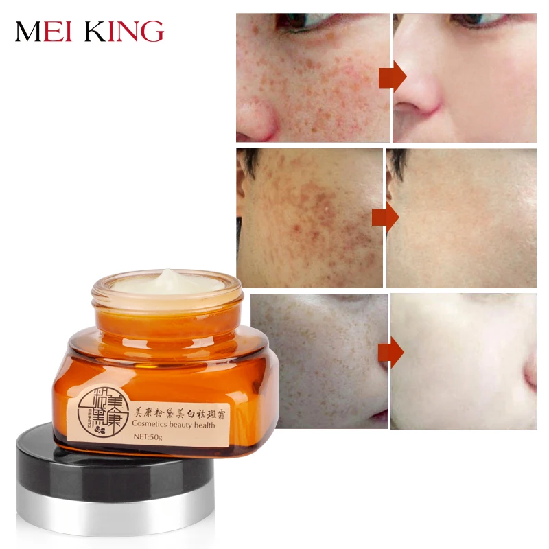 Дешево MEIKING крем для лица Уход за кожей Удалить Веснушки Дневной крем для ухода за кожей Отбеливание Осветляющий Удалить увлажняющий для лица отбе...