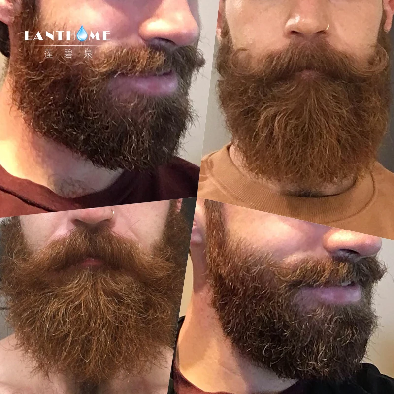 Бакенбарды у мужчин. Недельная борода. Как быстро растет борода. Стадии отращивания бороды. Этапы роста бороды.