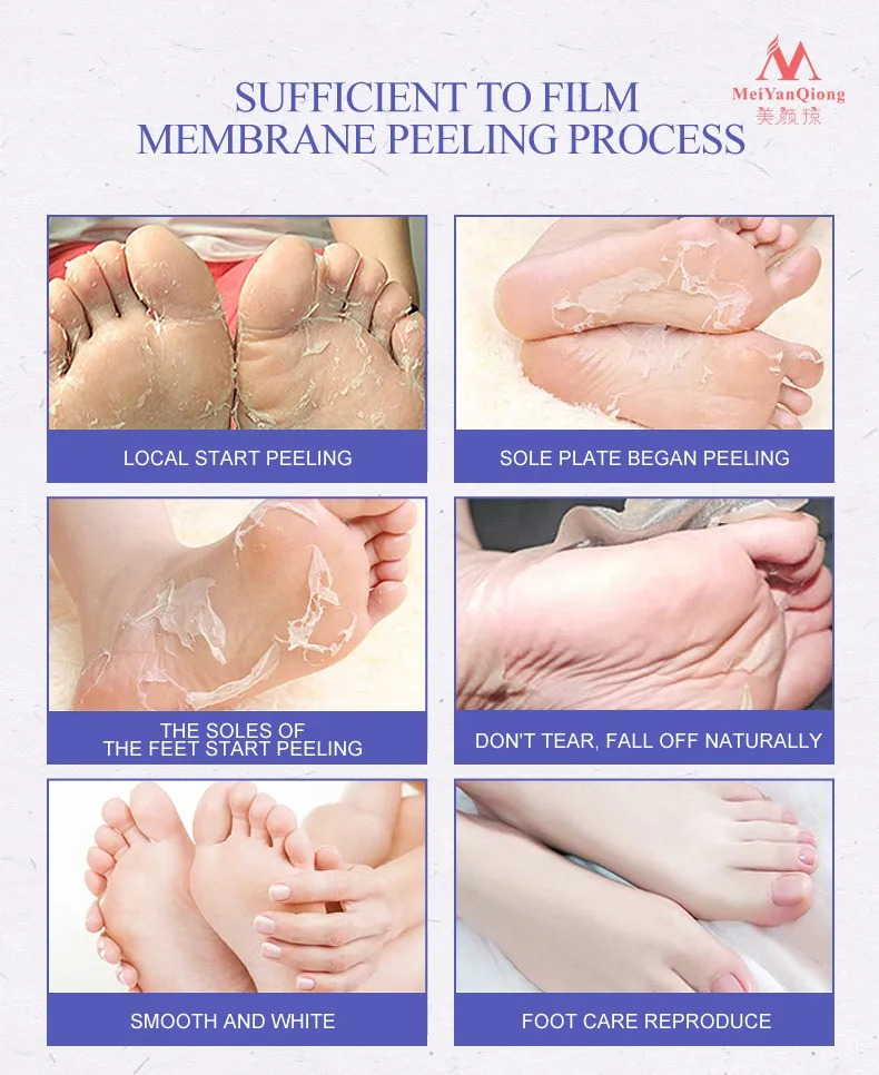 Remover a Pele Gengibre e Lavanda Cuidados com os Pés Morta Esfoliante Máscara Nutrida Peeling Cutículas Calcanhar Pés Cuidados Creme pé 12 Remover a pele morta esfoliante pé máscara