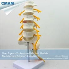 12387/поясничная позвонка колонна Sacrum со съемным Cutaway, обучение медицине анатомических моделей