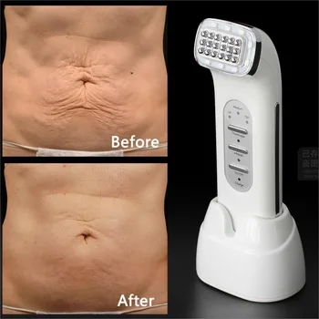 Real Remove Wrinkles Dot Matrix Facial Thermage Radio Frequency Lifting Face Lift Body SKin Care Beauty Device 110-240V