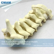 12312/C1-C7 шейного позвонка Кости Модель для тренировок, Медицинские Учебные анатомические модели