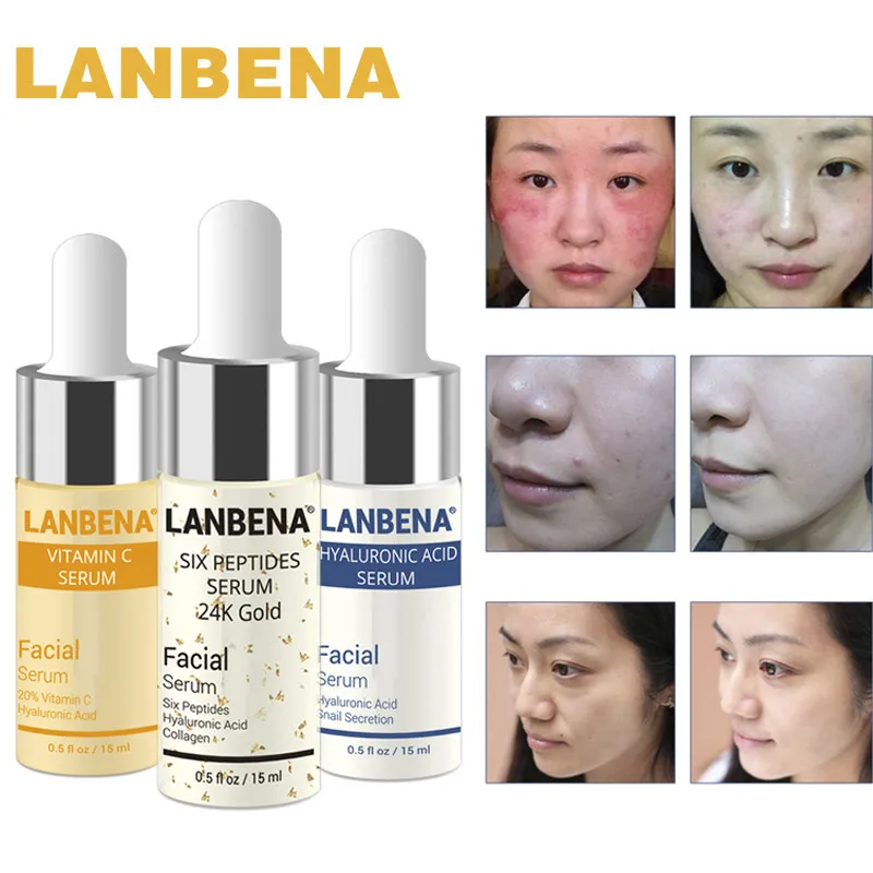 Lanbena Hyaluronic Acid Serum Vitamin C Serum Enam Peptida Serum 24k Emas Jerawat Krim Wajah Whitening Cream Pelembab Mencerahkan Serum Aliexpress Lanbena Hyaluronic Acid Serum Vitamin C Serum Enam Peptida Serum 24k Emas Jerawat Krim Wajah Whitening Cream Pelembab Mencerahkan Serum Aliexpress