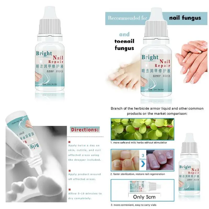 High Quality 10ml Nail Fungal Treatment Anti Fungus Onychomycosis Removal Toenail Care Nails Repair Liquid
