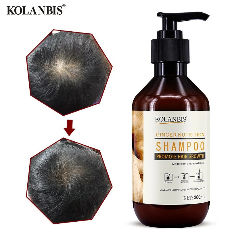 Najtaniej Pielęgnacja włosów organiczne rośliny ziołowe naturalny imbir szampon do wzrostu włosów przeciwłupieżowy utrata włosów oczyszczający olej mężczyźni tłusta pielęgnacja włosów