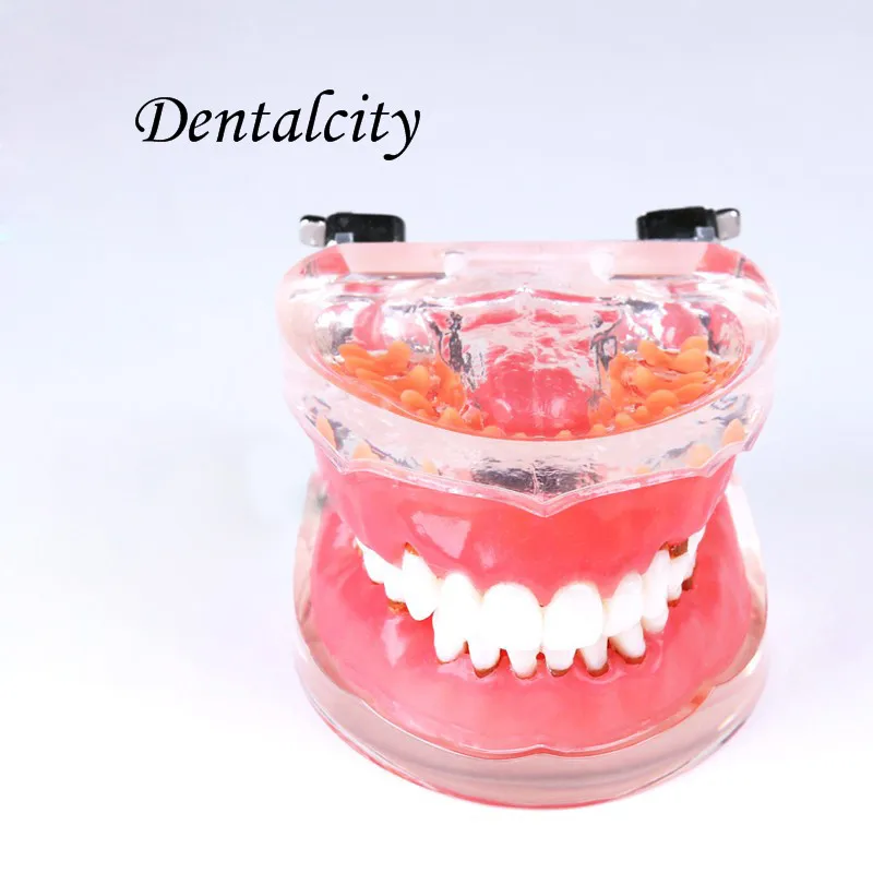Modelo de Dentes Novo Dentais Typodon Adulto Doença Periodontal Patológica 4017 4 High Quality Beleza e saúde