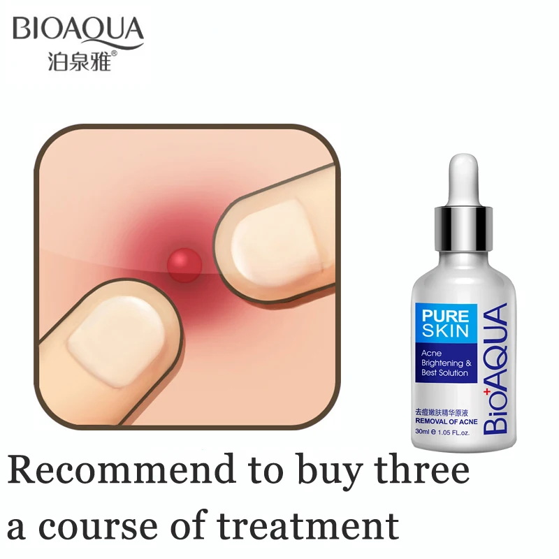 Бренд BIOAQUA 30 мл лечение акне субстанция от угревой сыпи удаление рубцов пятен