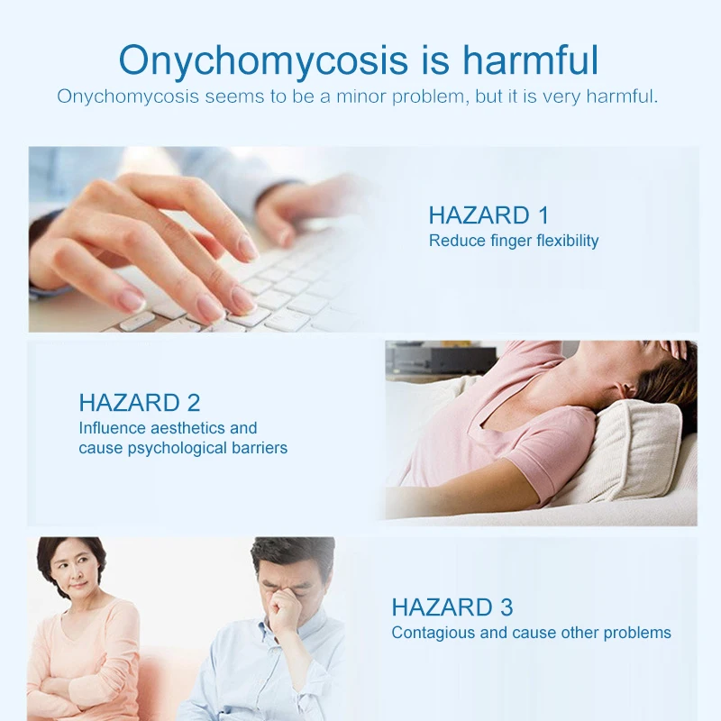 Onychomycosis ремонт ручка Лечение ногтей от грибка эффективный параонихиа грибка гель Уход за ногтями средство для удаления кутикулы дезинфекция TSLM1