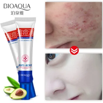

200PCS BIOAQUA Acne Scar Treatment Cream Oil Control Shrink Pores Remove Pimples Repair Acne Scars Anti Acne Gel Skin Care